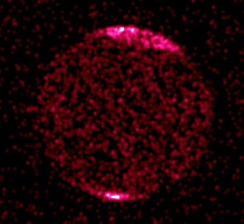 Chandra X-ray image